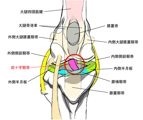 前十字靱帯断裂